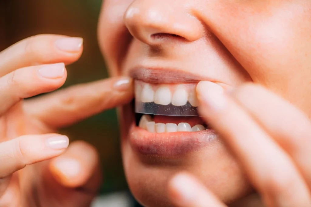 The Truth About Whitening Your Teeth: What’s Safe and What to Avoid Whitening your teeth - Arden Family Dental, Arden, NC