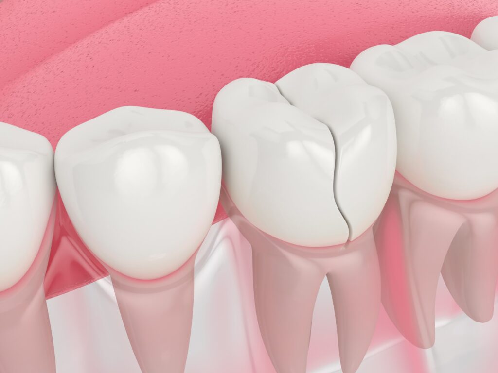 Emergency Dentist Near Me Emergency Dentist Near Me Arden NC