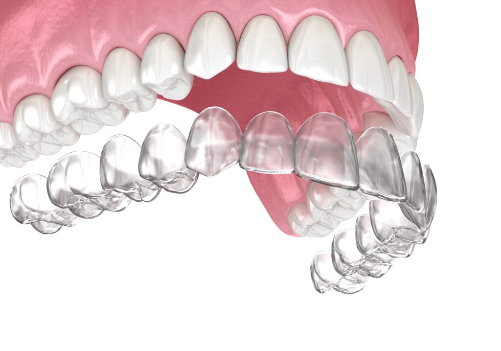 Orthodontic Services Orthodontic Services Arden NC