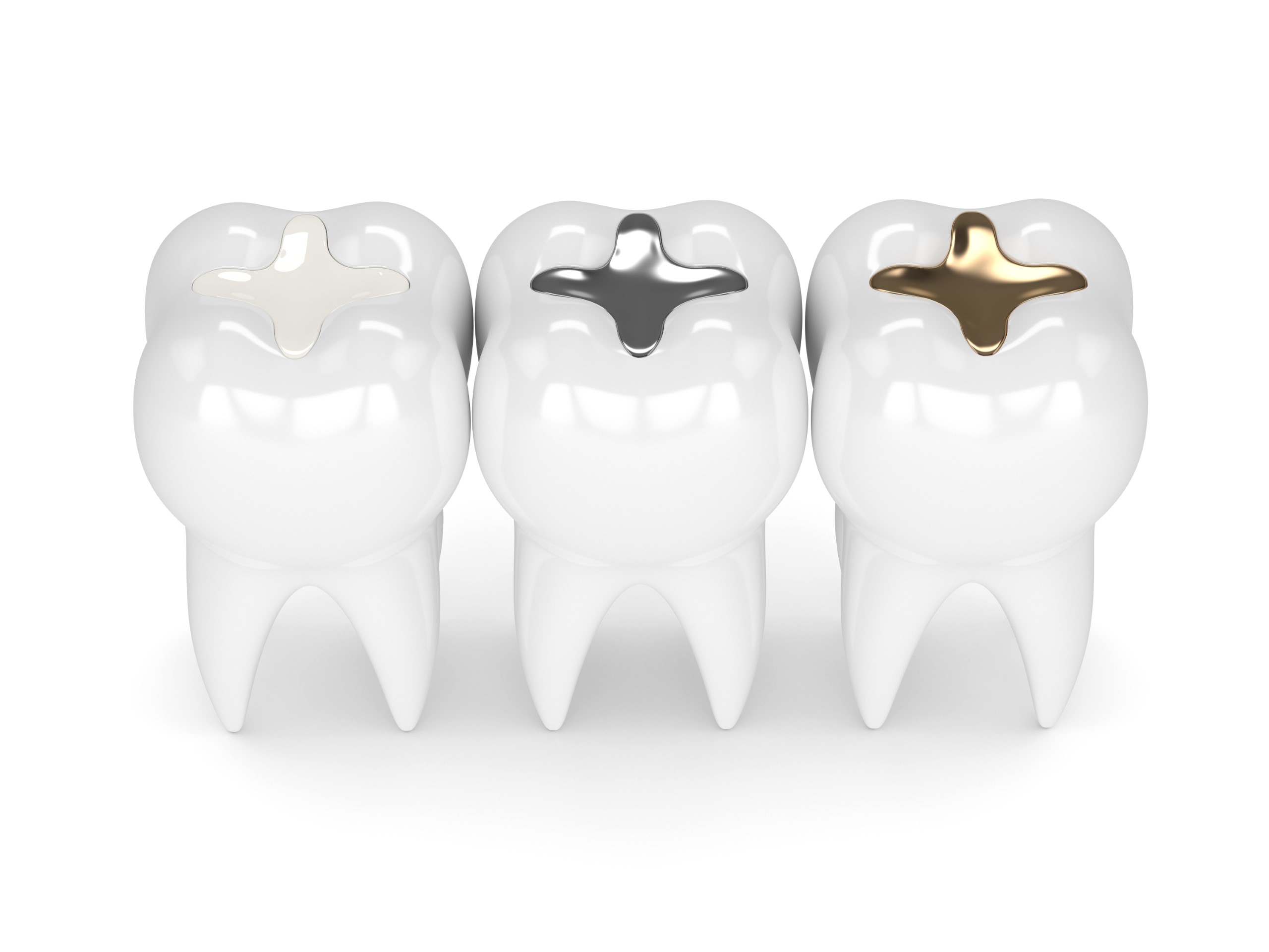 Tooth Filling Arden NC
