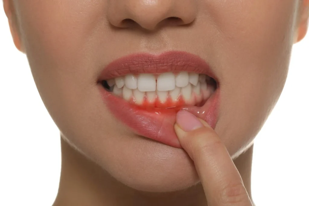 Toothache Warning Signs: When It’s Time to Call Your Dentist Toothache - Arden, NC