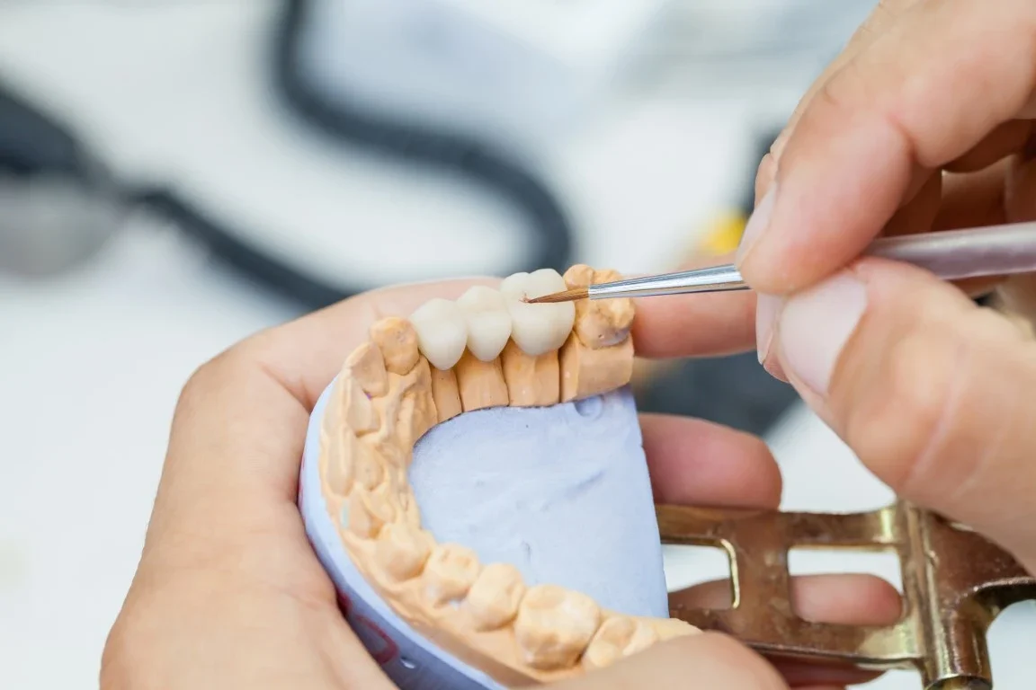 Implants - Arden, NC 
