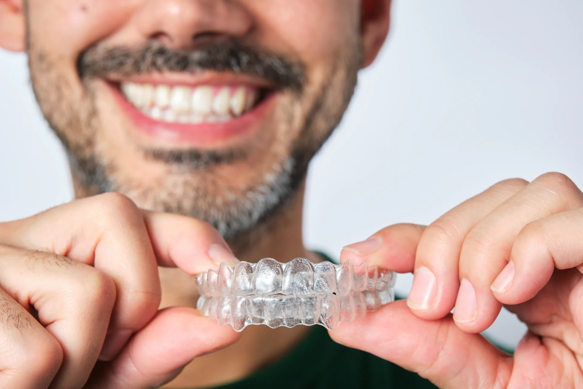 Why Arden Adults are Choosing Clear Aligners Over Traditional Braces